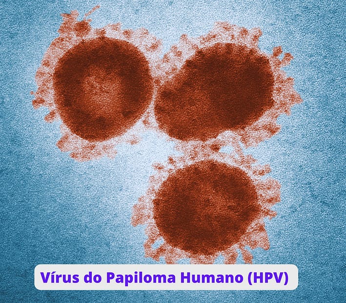 Vírus do Papiloma Humano (HPV)