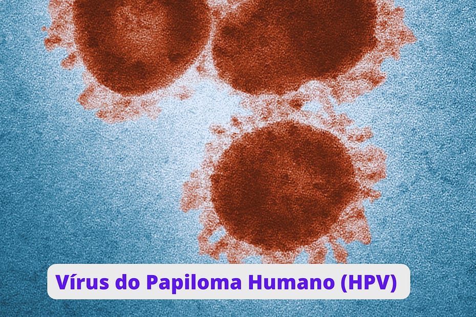 Vírus do Papiloma Humano (HPV)